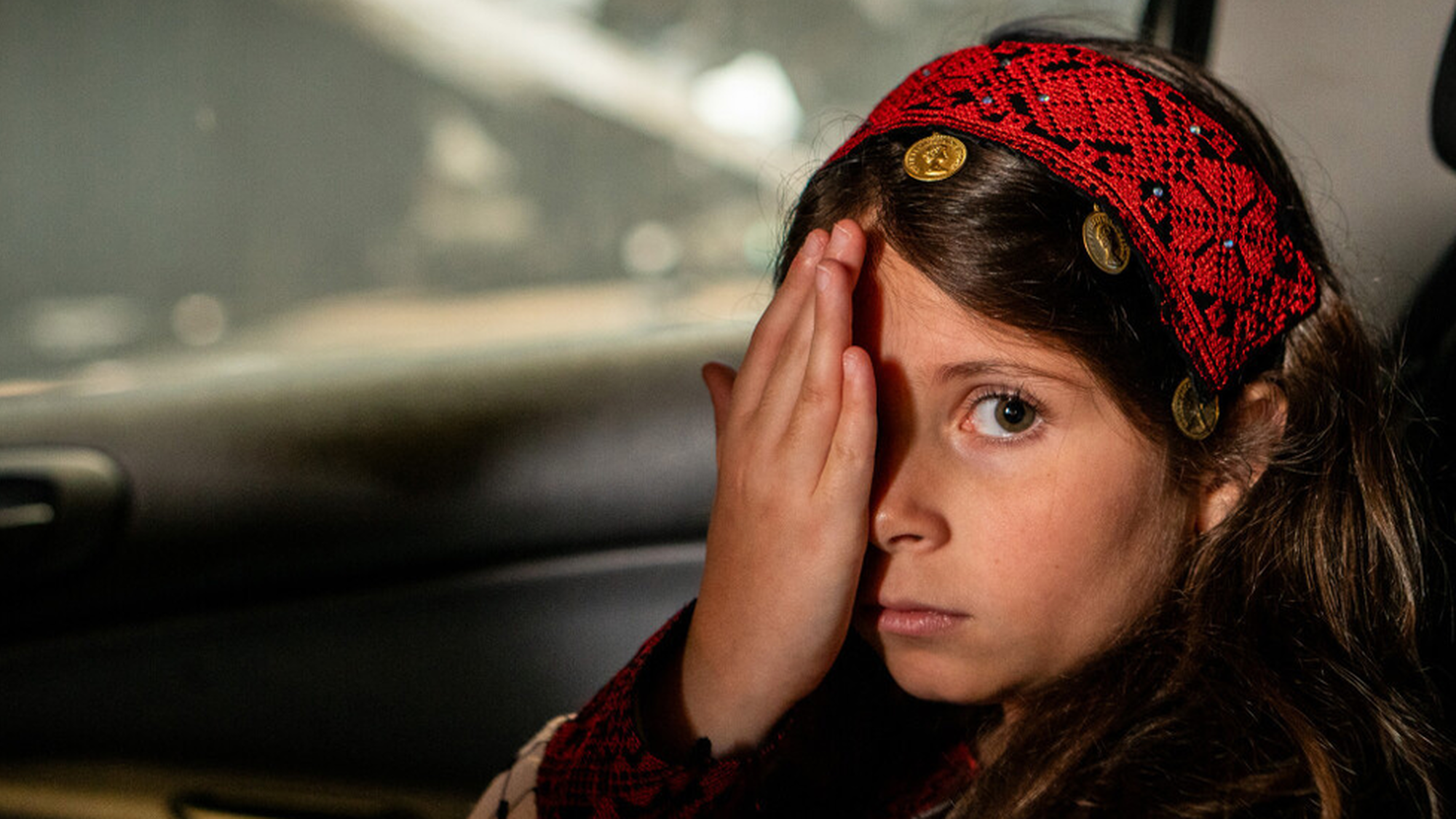 Meisje van vijf houdt een hand over haar linker oog en kijkt de camera in. Ze zit op de achterbank van een auto